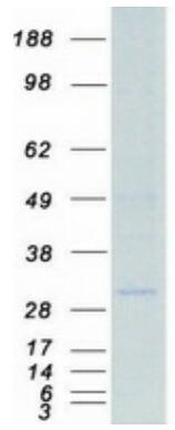 Coomassie blue staining of purified HLA-DQA1 protein.